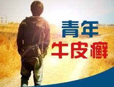 青少年治疗牛皮癣要注意什么